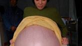 「懷胎12個月」沒生…做完超音波秒遭老公拋棄 她挺50kg巨肚流浪