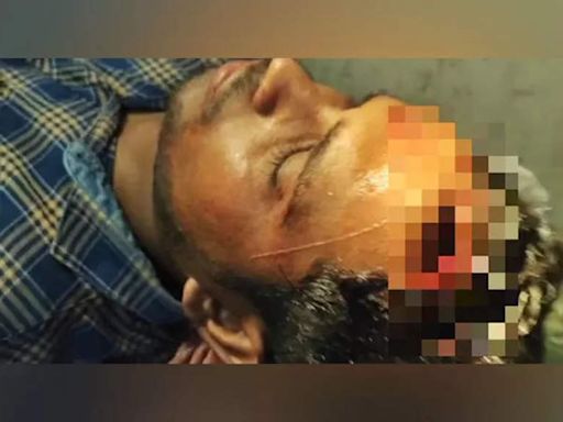 West Bengal: Journalist injured in TMC-BJP clashes during Lok Sabha polls | Kolkata News - Times of India