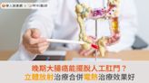 晚期大腸癌能擺脫人工肛門？立體放射治療合併電熱治療效果好 | 華人健康網 - 專業即時優質的健康新聞及資訊分享平台業即時優質的健康新聞及資訊分享平台