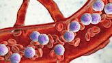 Menin inhibitors seek to debut as newest targeted therapy for leukaemia