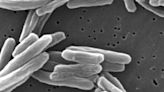 With pandemic over, deadliest infectious disease in U.S. is still tuberculosis