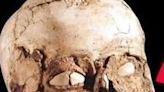 10 Ancient Skulls With Fascinating Secrets