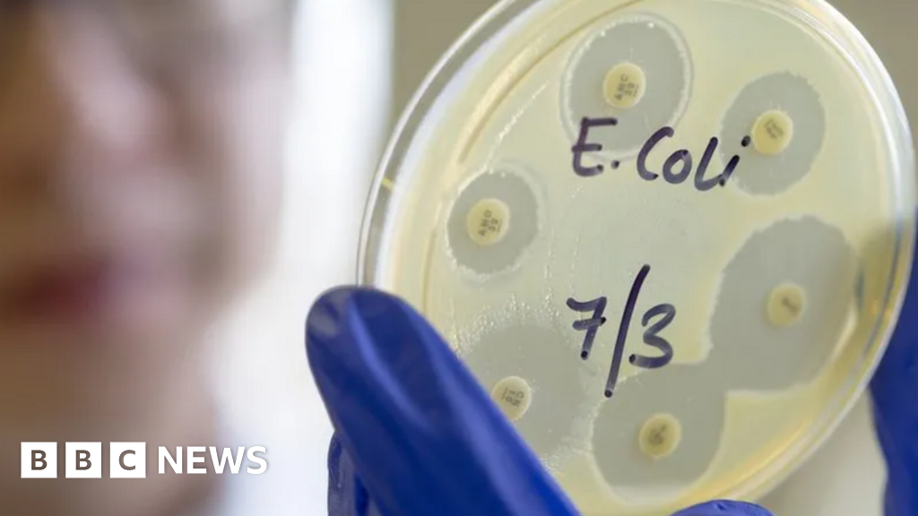 E. coli: Person dies in outbreak linked to salad leaves