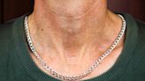 Colorado Man Saved From Near-Fatal Bullet Wound by Silver Necklace