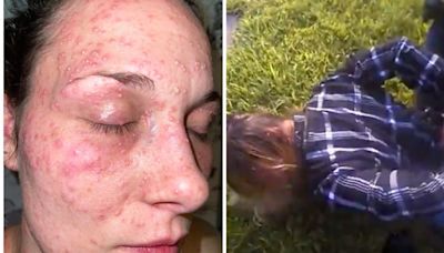 Police In Texas Held Woman's Face Down To Fire Ants, Federal Lawsuit Says