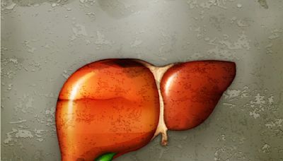 40歲工程師常吃保肝產品！醫檢查：重度脂肪肝 飲食習慣曝光