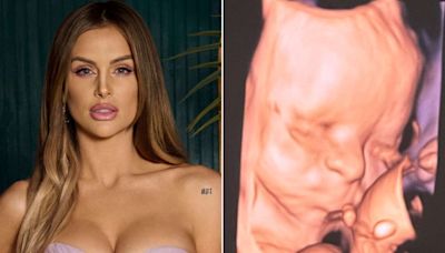 Pregnant Lala Kent Shares Ultrasound Image of Her Baby Girl: 'We Can't Wait to Welcome You'