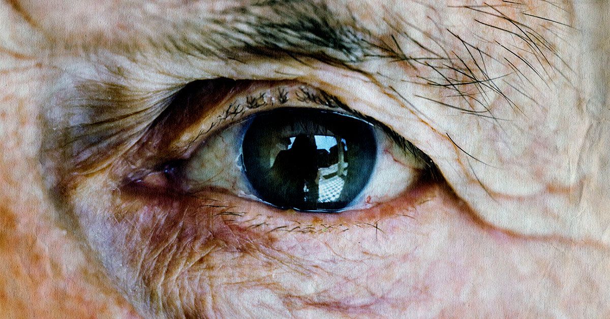 Can glaucoma be fatal? Prognosis, blindness risk, and treatment