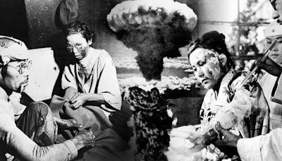 Hiroshima survivor breaks silence 79yrs after nuke blast burned faces off