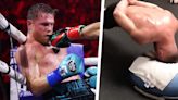 Boxer Canelo Alvarez Shares Neck Exercise in Viral Video Which Doctors Are Labelling 'Dangerous'