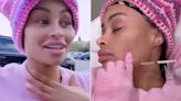 Blac Chyna Reveals Results of Having Her Facial Fillers Dissolved After 'Looking like Jigsaw'