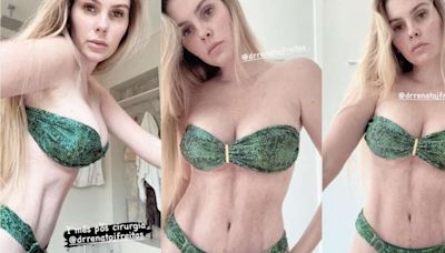 Bárbara Evans mostra o corpo um mês após cirurgias plásticas; veja fotos!