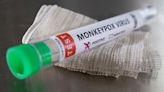 Brazil health officials await test results to confirm first monkeypox case