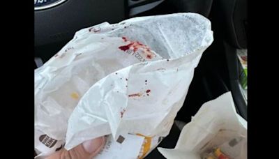 New York mother finds blood spots inside packed Burger King meal, shares horrifying account: ‘There’s blood all over…’ | Today News