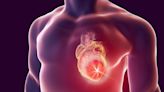 Concerning Findings – This Severe Heart Disease Is Becoming Much More Common