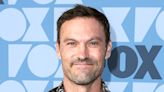 Brian Austin Green's Ulcerative Colitis Explained by a Gastroenterologist