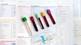 What do your blood test results mean? A toxicologist explains the basics of how to interpret them