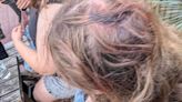 Counter-protester bricked in the head during Bristol protests