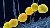 Brote de Streptococcus pyogenes: crece la preocupación por la bacteria que ya causó 64 muertes en el país