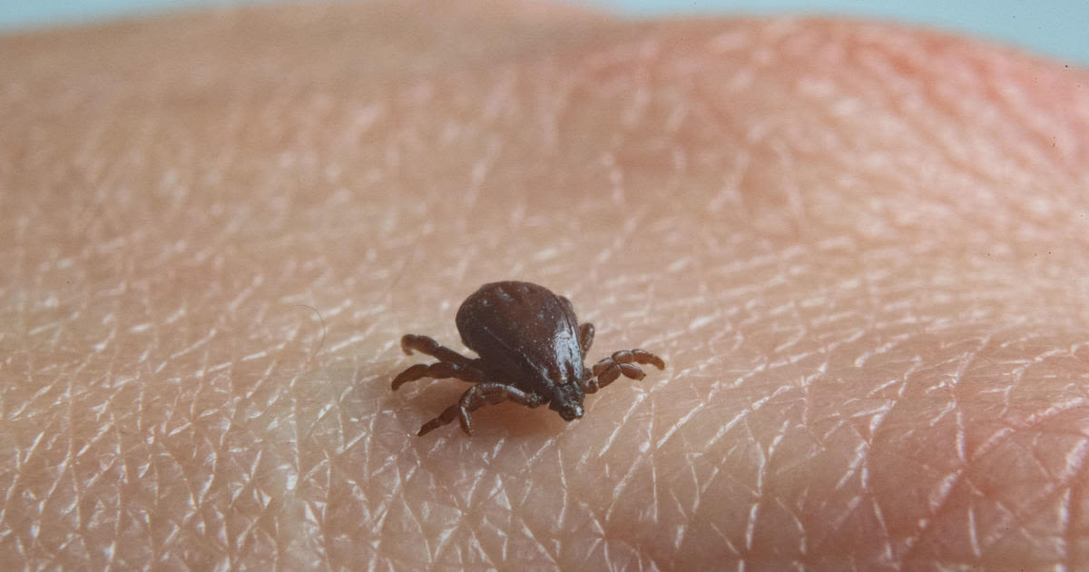 Ticks may be worse after the mild winter. Here's what you need to know about tick-borne disease.