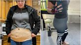 Woman turns excess skin from weight loss surgery into human leather