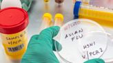 US to spend $200m to stop bird flu spreading on dairy farms