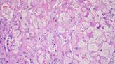 Researchers decipher mechanisms of liver regeneration