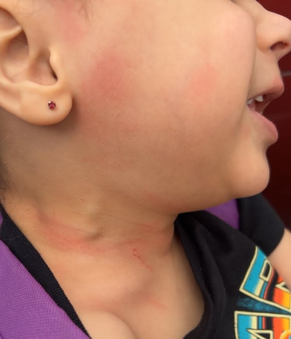 Tacoma mother says 4-year-old non-verbal daughter was choked by school bus driver