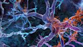 ALS and Dementia Share Molecular Links - Neuroscience News