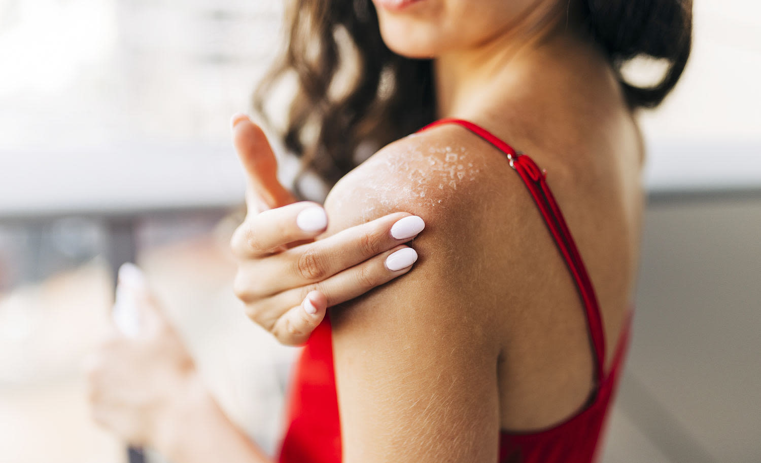 Have a sunburn? Dermatologists share 8 ways to heal and feel better — fast