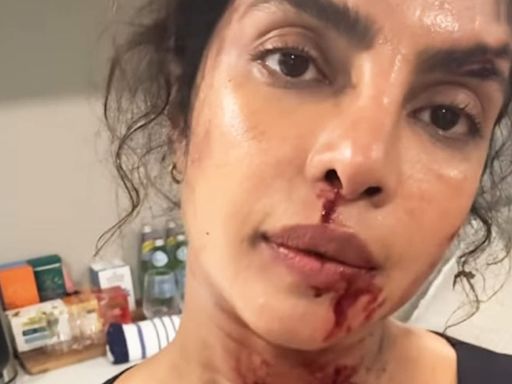 Priyanka Chopra flaunts bruises she sustained during shoot in The Bluff BTS