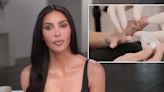 Kim Kardashian shows off seriously gruesome injury after breaking fingertip