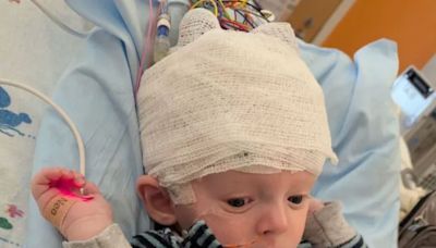 3-Month-Old Baby Has Half of His Brain Removed After Suffering 200 Seizures a Day from Rare Disorder