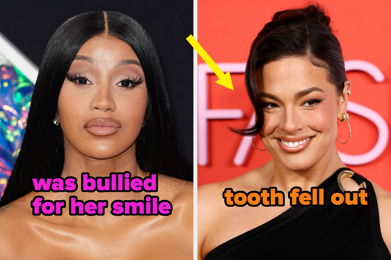 It Feels Like Everyone Is Getting Veneers, So Here Are 20 Celebs Who Have Them