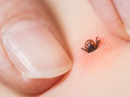 Tick season: What to know about Lyme disease as 'more resilient' ticks this year as parts of Canada see double-digit temperatures