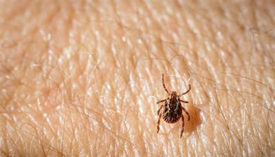Rocky Mountain Spotted Fever: What You Need to Know