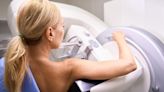 What to Know About Breast Cancer Screening Guidelines