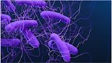 Study identifies protein that affects health of gut microbiota and response to bacterial infection