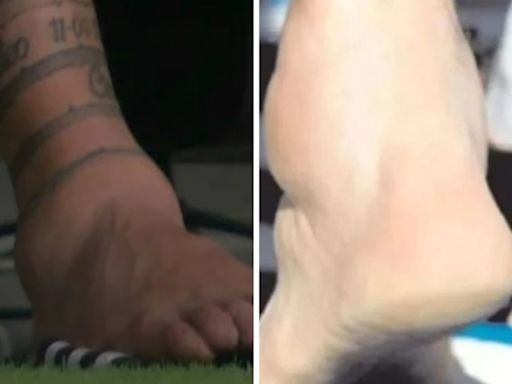 Messi y la comparación al infinito con Maradona: el tobillo que sacó a Leo de la final de la Copa América y el recuerdo de Diego en el '90