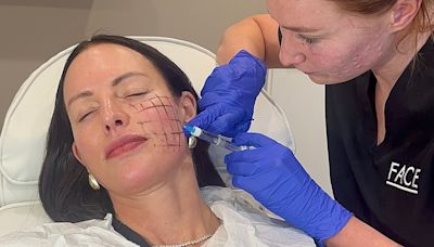 Alex Pike, 46, shows off the results of her salmon sperm facial