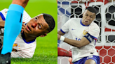 ¡DURÍSIMO! La FUERTE LESIÓN que sufrió Kylian Mbappé en su debut en la Eurocopa: “NO ESTÁ BIEN...”