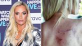 Teddi Mellencamp Arroyave Gives Update On Melanoma Diagnosis: 'Initial Prescription Wasn't Working'