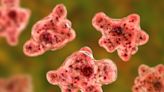 Swimmer contracts rare brain-eating amoeba from lake in Iowa