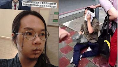 快訊／「中捷長髮哥」近況曝光！臉留兩條長疤 網爆心疼