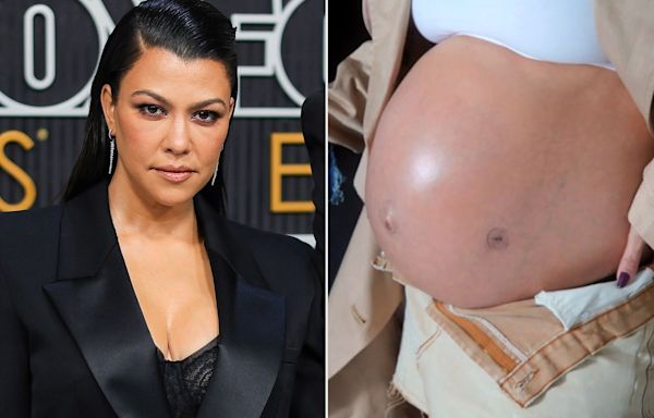 Pregnant Kourtney Kardashian Shows Scar from Fetal Surgery During Maternity Photo Shoot: 'Fragile Little Egg'