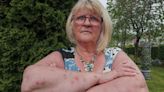TUI under fire as Marjorie, 66, left looking like this