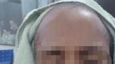 Polícia prende homem por agredir mulher a marteladas e obrigá-la a raspar o próprio cabelo | Rio de Janeiro | O Dia