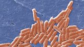 What is salmonella and how is it spread? Hospital admissions for food poisoning reach all time high