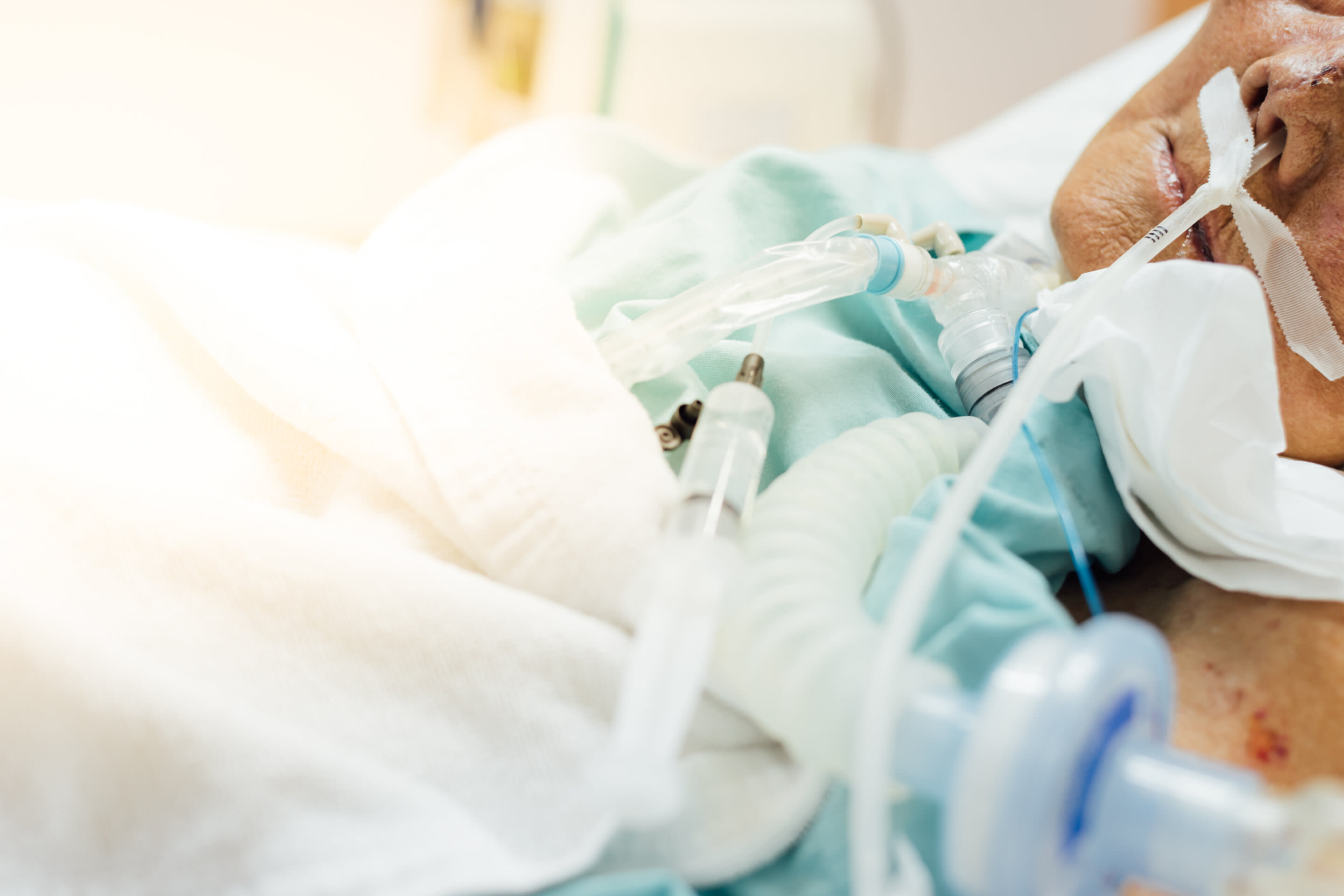 Hospitals caring for diverse patient populations found to have higher mechanical ventilation mortality