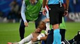 Mbappe breaks nose in France Euro 2024 win | Fox 11 Tri Cities Fox 41 Yakima